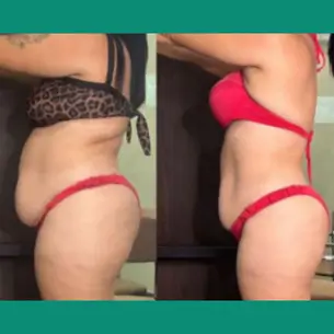 2clinica de estetica 305x305