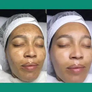 3clinica de estetica 305x305