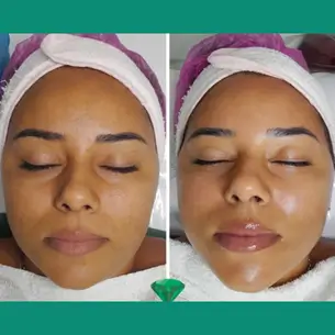 clinica de estetica 305x305